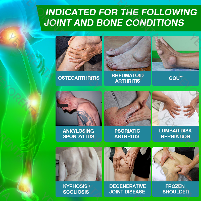 โก๏ธ๐ฆดCA Owned & Operated | Clinically Formulated by Orthopaedic Specialists: ๐น๐๐๐๐๐ยฎ ๐ป๐ฉ-๐๐๐ ๐ฉ๐๐๐น๐๐๐๐๐ ๐ช๐๐๐๐ โ Rapid Pain Relief & Cellular Joint Regeneration (๐ฅ Up to 80% OFF)