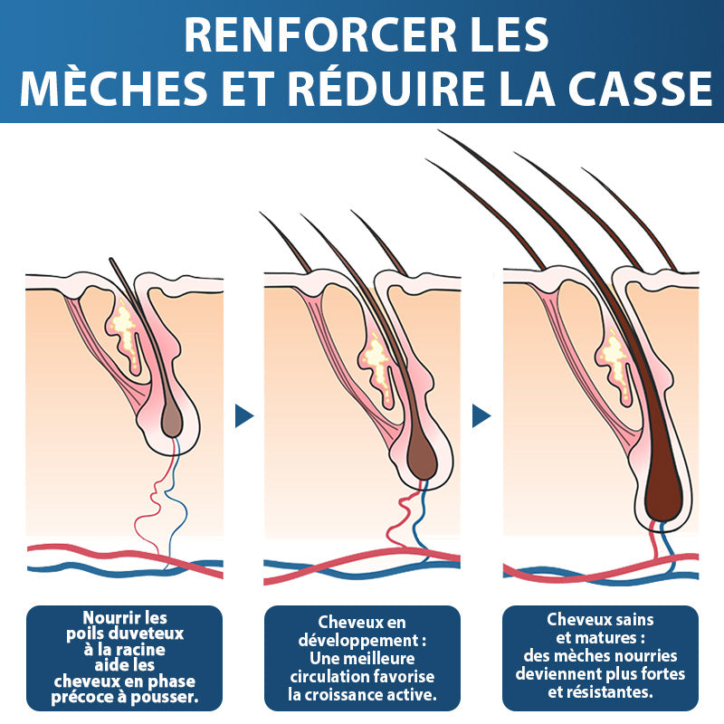 🇨🇦🍁Développé par des trichologues: 𝐑𝐨𝐥𝐢𝐦𝐞𝐲® 𝐒𝐓𝐄𝐌 𝐂𝐞𝐥𝐥 𝐇𝐚𝐢𝐫 𝐂𝐲𝐜𝐥𝐞 𝐑𝐨𝐥𝐥𝐞𝐫 – Stoppe instantanément la perte de cheveux et favorise une repousse réelle(🔥JUSQU’À 80% DE RABAIS)