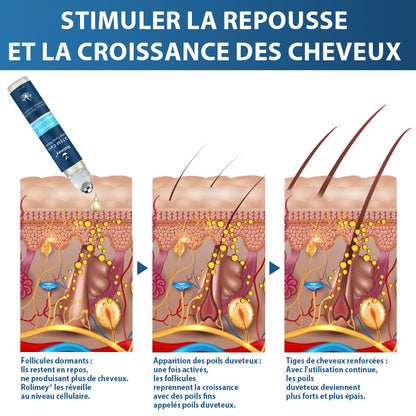 🇨🇦🍁Développé par des trichologues: 𝐑𝐨𝐥𝐢𝐦𝐞𝐲® 𝐒𝐓𝐄𝐌 𝐂𝐞𝐥𝐥 𝐇𝐚𝐢𝐫 𝐂𝐲𝐜𝐥𝐞 𝐑𝐨𝐥𝐥𝐞𝐫 – Stoppe instantanément la perte de cheveux et favorise une repousse réelle(🔥JUSQU’À 80% DE RABAIS)