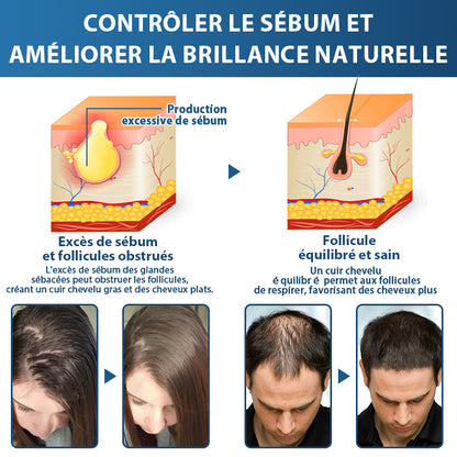 🇨🇦🍁Développé par des trichologues: 𝐑𝐨𝐥𝐢𝐦𝐞𝐲® 𝐒𝐓𝐄𝐌 𝐂𝐞𝐥𝐥 𝐇𝐚𝐢𝐫 𝐂𝐲𝐜𝐥𝐞 𝐑𝐨𝐥𝐥𝐞𝐫 – Stoppe instantanément la perte de cheveux et favorise une repousse réelle(🔥JUSQU’À 80% DE RABAIS)