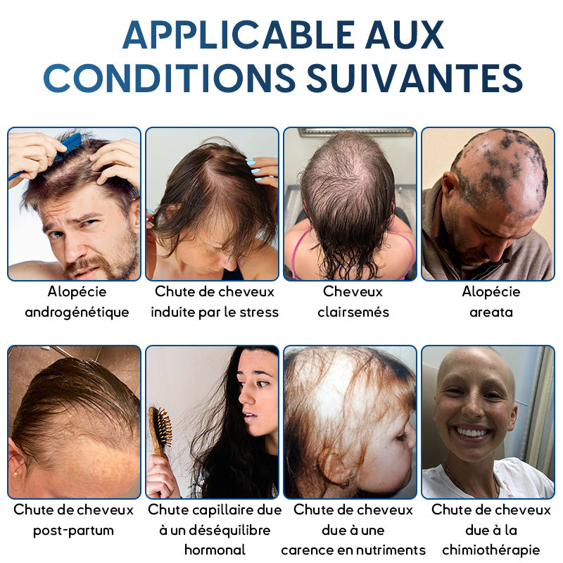 🇨🇦🍁Développé par des trichologues: 𝐑𝐨𝐥𝐢𝐦𝐞𝐲® 𝐒𝐓𝐄𝐌 𝐂𝐞𝐥𝐥 𝐇𝐚𝐢𝐫 𝐂𝐲𝐜𝐥𝐞 𝐑𝐨𝐥𝐥𝐞𝐫 – Stoppe instantanément la perte de cheveux et favorise une repousse réelle(🔥JUSQU’À 80% DE RABAIS)
