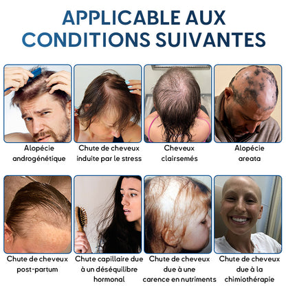 🇨🇦🍁Développé par des trichologues: 𝐑𝐨𝐥𝐢𝐦𝐞𝐲® 𝐒𝐓𝐄𝐌 𝐂𝐞𝐥𝐥 𝐇𝐚𝐢𝐫 𝐂𝐲𝐜𝐥𝐞 𝐑𝐨𝐥𝐥𝐞𝐫 – Stoppe instantanément la perte de cheveux et favorise une repousse réelle(🔥JUSQU’À 80% DE RABAIS)
