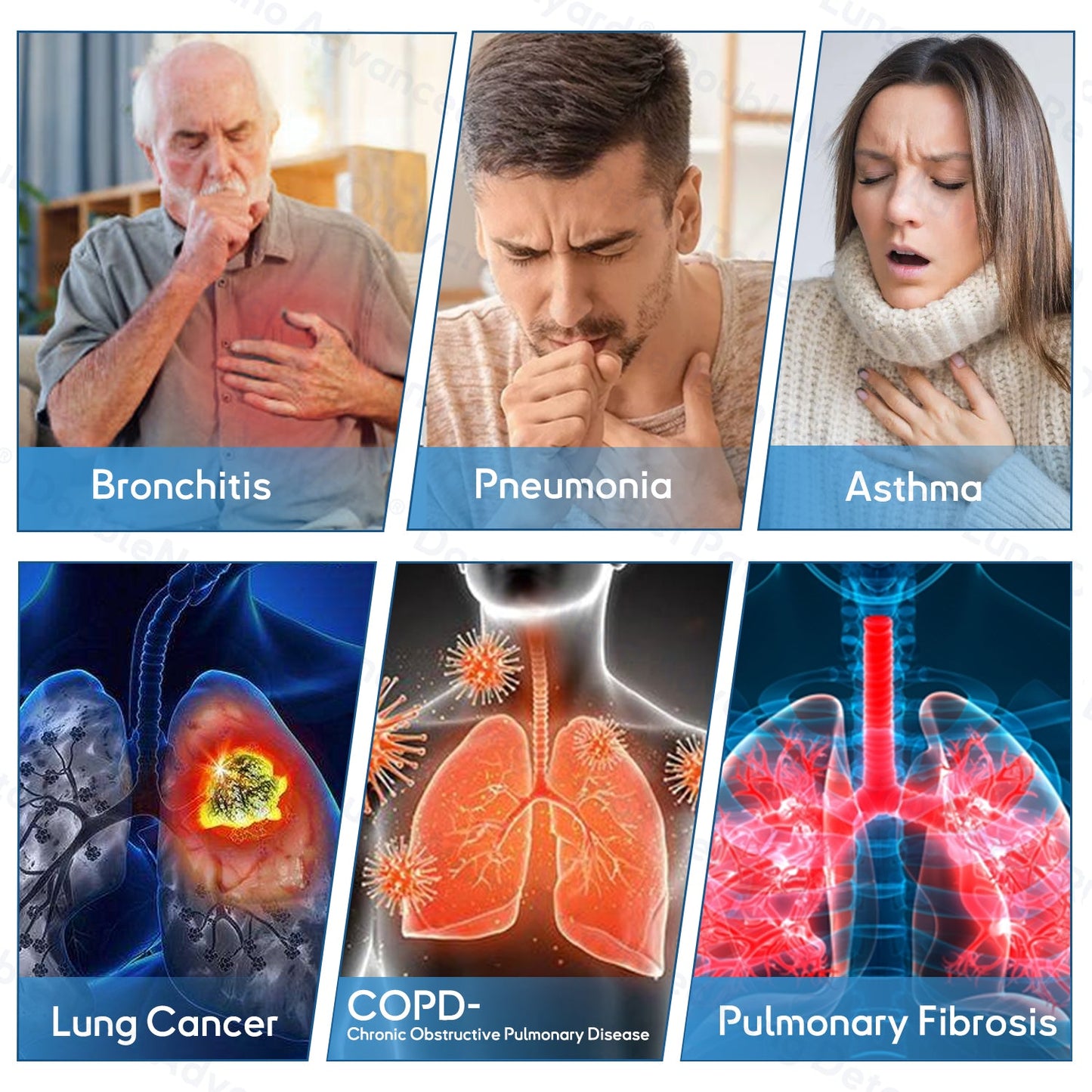 CAUP16:🍁✅𝐎𝐟𝐟𝐢𝐜𝐢𝐚𝐥 𝐒𝐭𝐨𝐫𝐞:𝐎𝐮𝐫𝐥𝐲𝐚𝐫𝐝®  𝐃𝐨𝐮𝐛𝐥𝐞𝐍𝐚𝐧𝐨 𝐀𝐝𝐯𝐚𝐧𝐜𝐞𝐝 𝐋𝐮𝐧𝐠 𝐃𝐞𝐭𝐨𝐱 𝐑𝐞𝐥𝐢𝐞𝐟 𝐏𝐚𝐭𝐜𝐡 (💝 Cough, wheezing, shortness of breath, sputum, stuffy nose, bronchitis, bronchitis, allergy symptoms, lung discomfort💝）