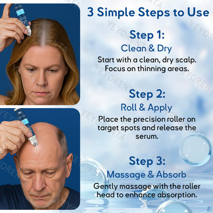 ✅CA Owned and Operated: 𝙍𝙤𝙡𝙞𝙢𝙚𝙮® 𝙎𝙏𝙀𝙈 𝘾𝙚𝙡𝙡 𝙃𝙖𝙞𝙧 𝘾𝙮𝙘𝙡𝙚 𝙍𝙤𝙡𝙡𝙚𝙧 (Male pattern baldness · Thinning hair · Receding hairline · Postpartum hair loss · Stress-related shedding · Ageing hair · Scalp discomfort)